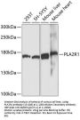 PLA2R1 Antibody