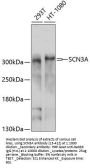 SCN3A Antibody