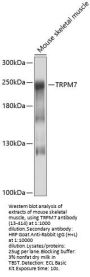 TRPM7 Antibody