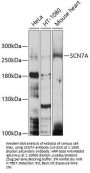 SCN7A Antibody