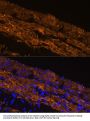 alpha smooth muscle actin Antibody