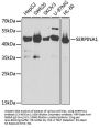 SERPINA1 Antibody