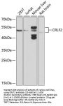 CRLF2 Antibody