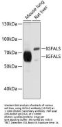IGFALS Antibody
