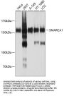 SMARCA1 Antibody
