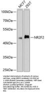 NR2F2 Antibody