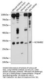 KCNMB2 Antibody