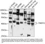 TMEFF2 Antibody