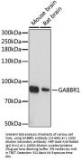 GABBR1 Antibody