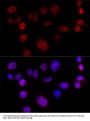 Cyclin D1 Antibody