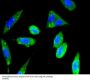 FAK Antibody [E1E5]
