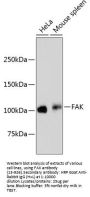 FAK Antibody [E1E5]