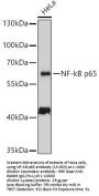 NF-kB p65 Antibody, KO Validated