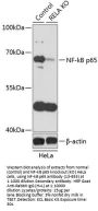 NF-kB p65 Antibody, KO Validated