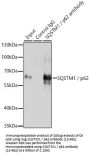 SQSTM1 / p62 Antibody