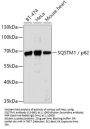SQSTM1 / p62 Antibody