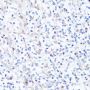 SQSTM1 / p62 Antibody