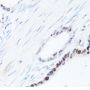 SQSTM1 / p62 Antibody