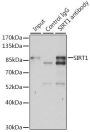 SIRT1 Antibody, KO Validated