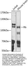 Rb Antibody