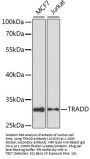 TRADD Antibody