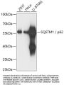 SQSTM1 / p62 Antibody, KO Validated