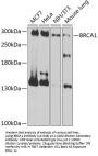 BRCA1 Antibody