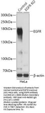 EGFR Antibody