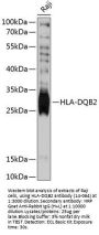 HLA-DQB2 Antibody