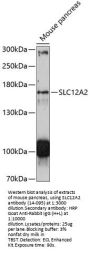 SLC12A2 Antibody