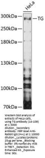 TG Antibody