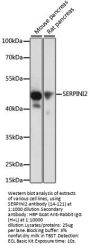SERPINI2 Antibody