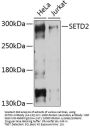 SETD2 Antibody