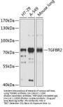 TGFBR2 Antibody