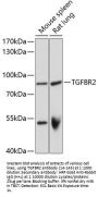 TGFBR2 Antibody