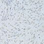 TARDBP Antibody