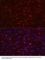 STAT3 Antibody, KO Validated