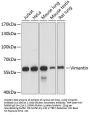 Vimentin Antibody, KO Validated
