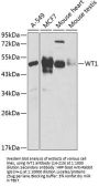 WT1 Antibody