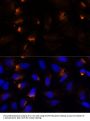 MMP3 Antibody