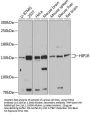 HIP1R Antibody