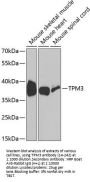 TPM3 Antibody