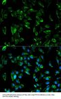 TPM3 Antibody