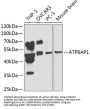 ATP6AP1 Antibody