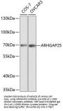 ARHGAP25 Antibody