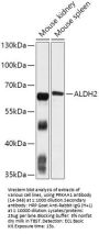 AMPK alpha 1 Antibody