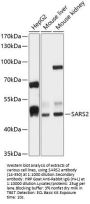 SARS2 Antibody