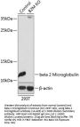 beta 2 Microglobulin Antibody, KO Validated