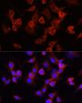 SERPINA1 Antibody