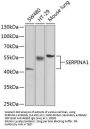 SERPINA1 Antibody